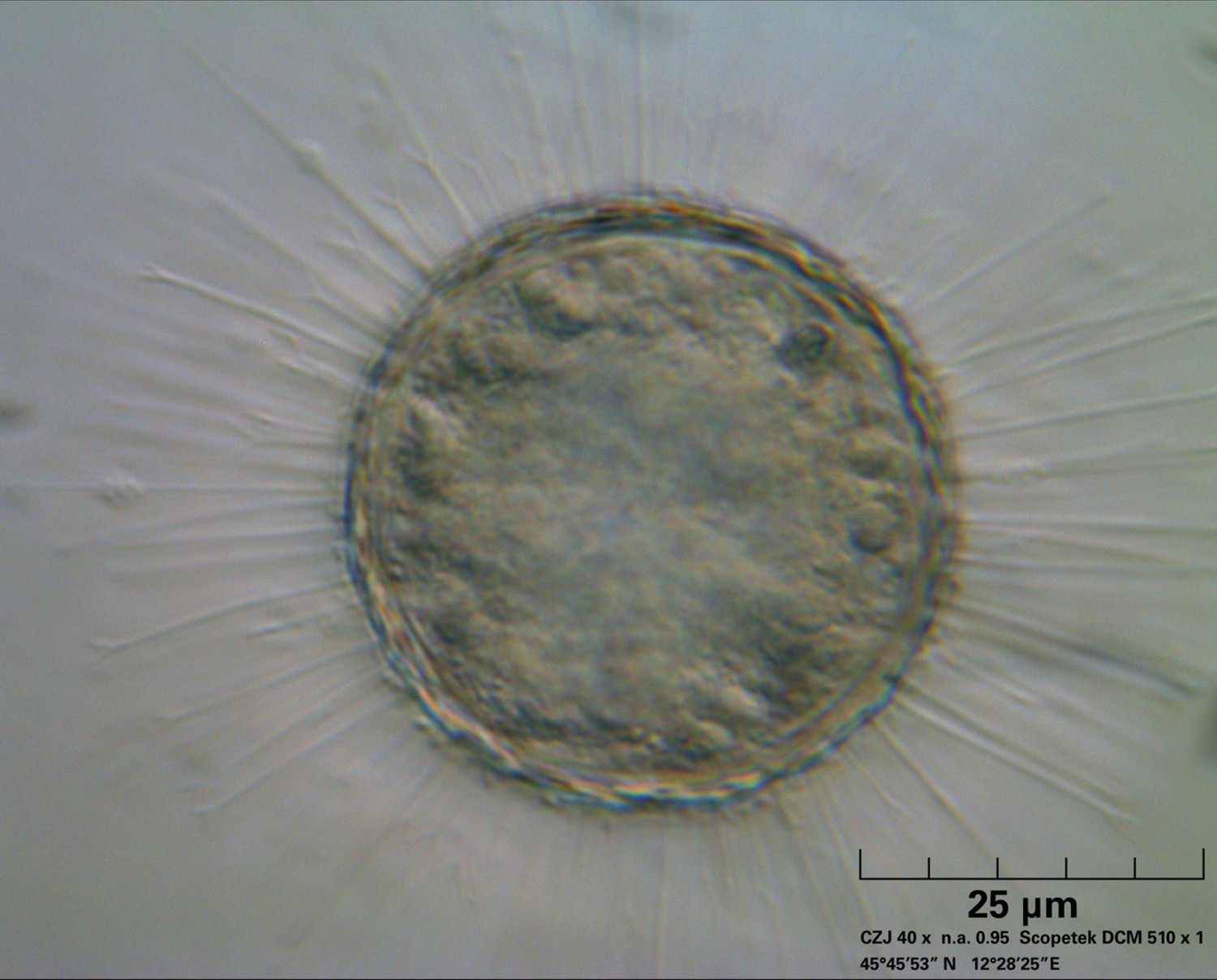 Acanthocystis